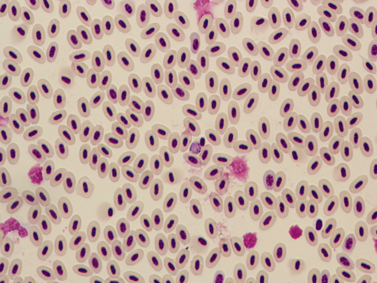 Avian malaria, or Plasmodium relictum, an infectious protozoan. U.S. Geological Survey
